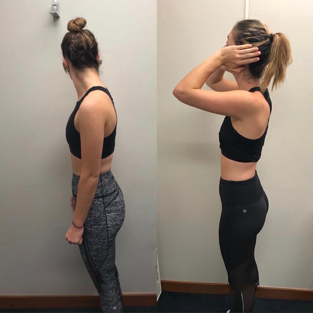Darcey H. transformation - before and after