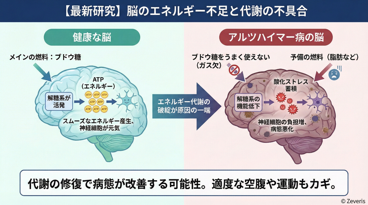 【最新研究】アルツハイマー病は「脳のエネルギー不足」が原因の一端か? 代謝の修復で病態が改善する可能性