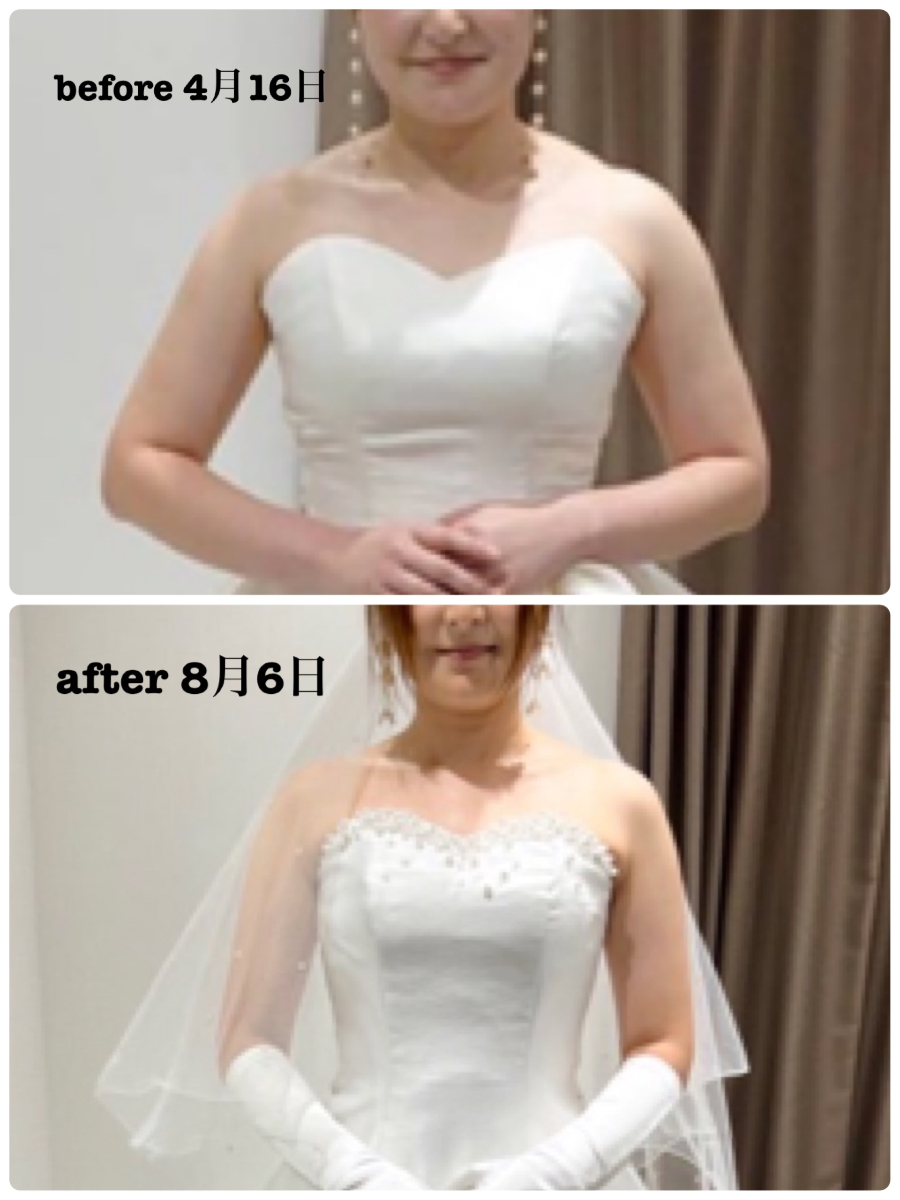 ダイエット成功事例 Before After