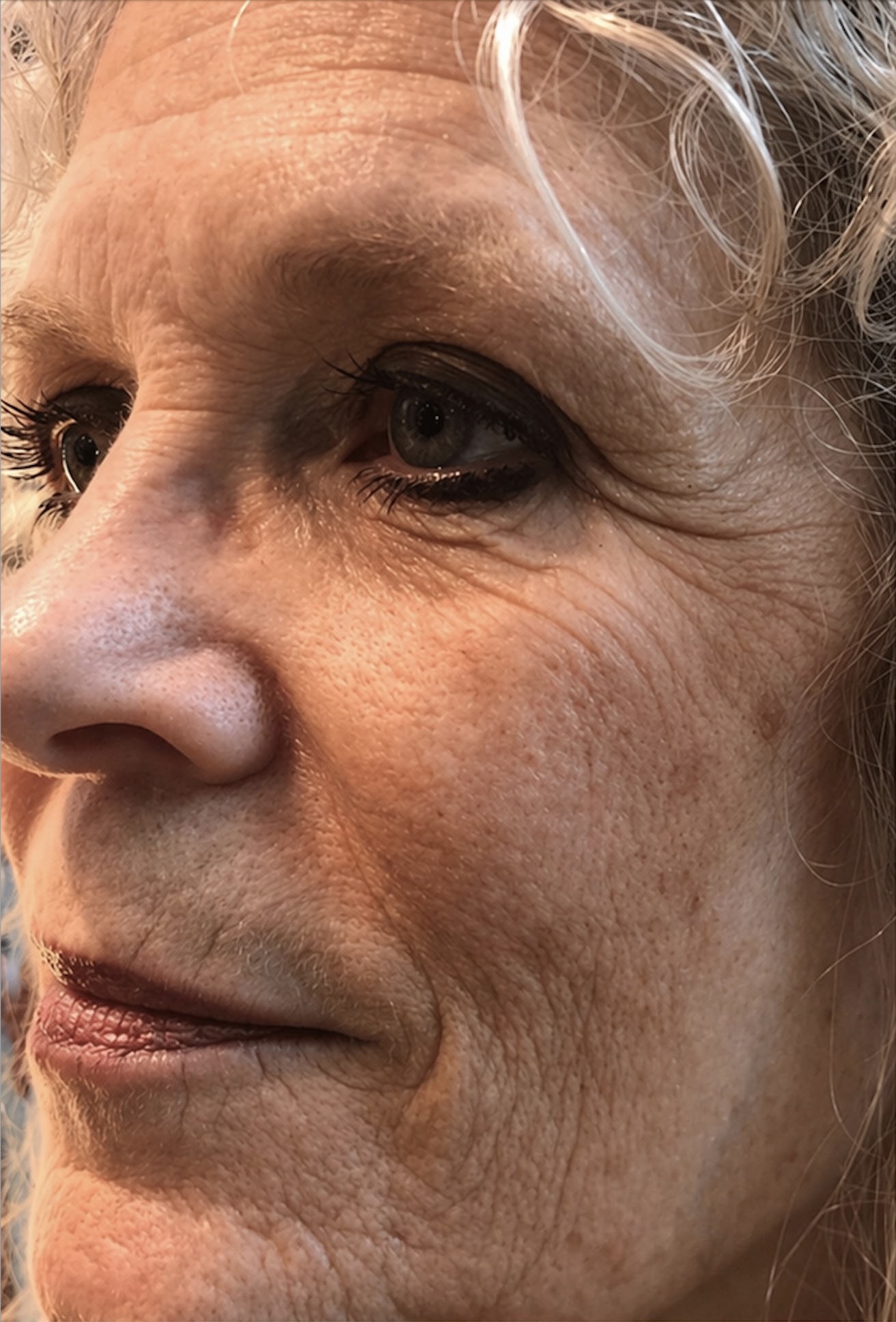 Skin before treatment