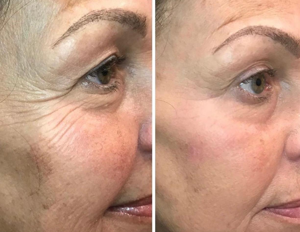 Organiq Spa facial treatment session