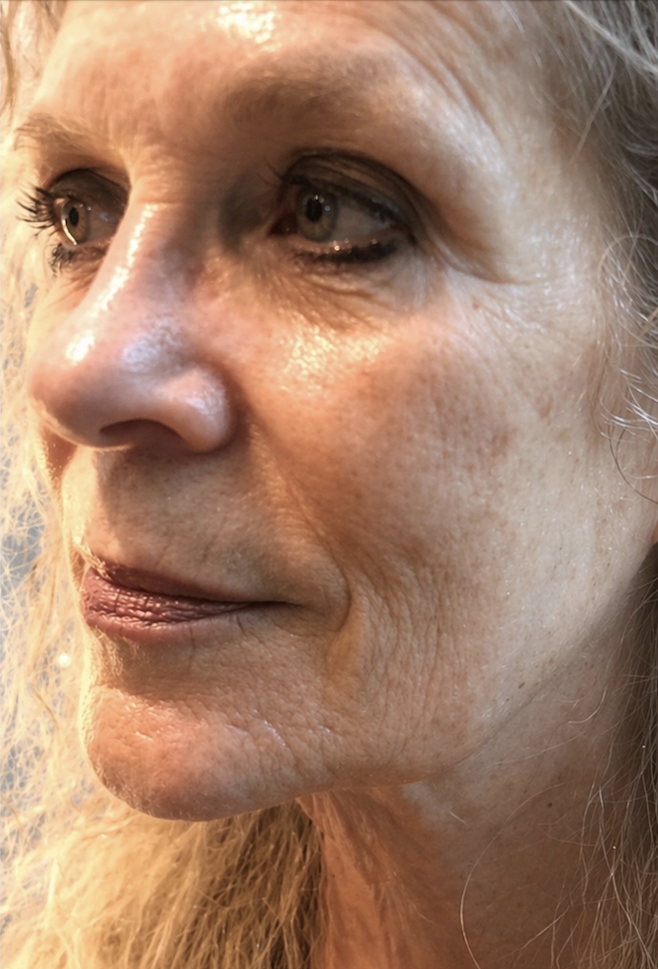 Skin after treatment