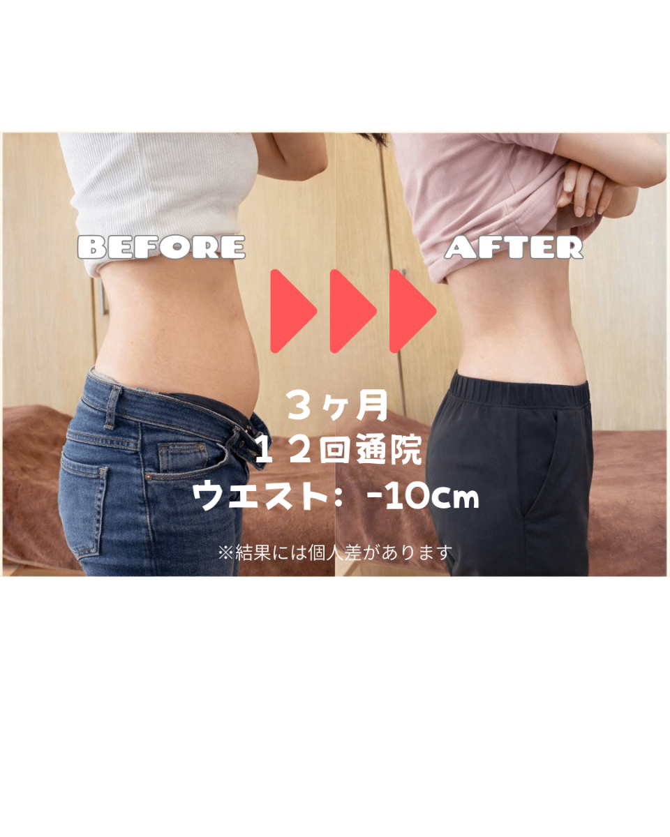 ビフォーアフター