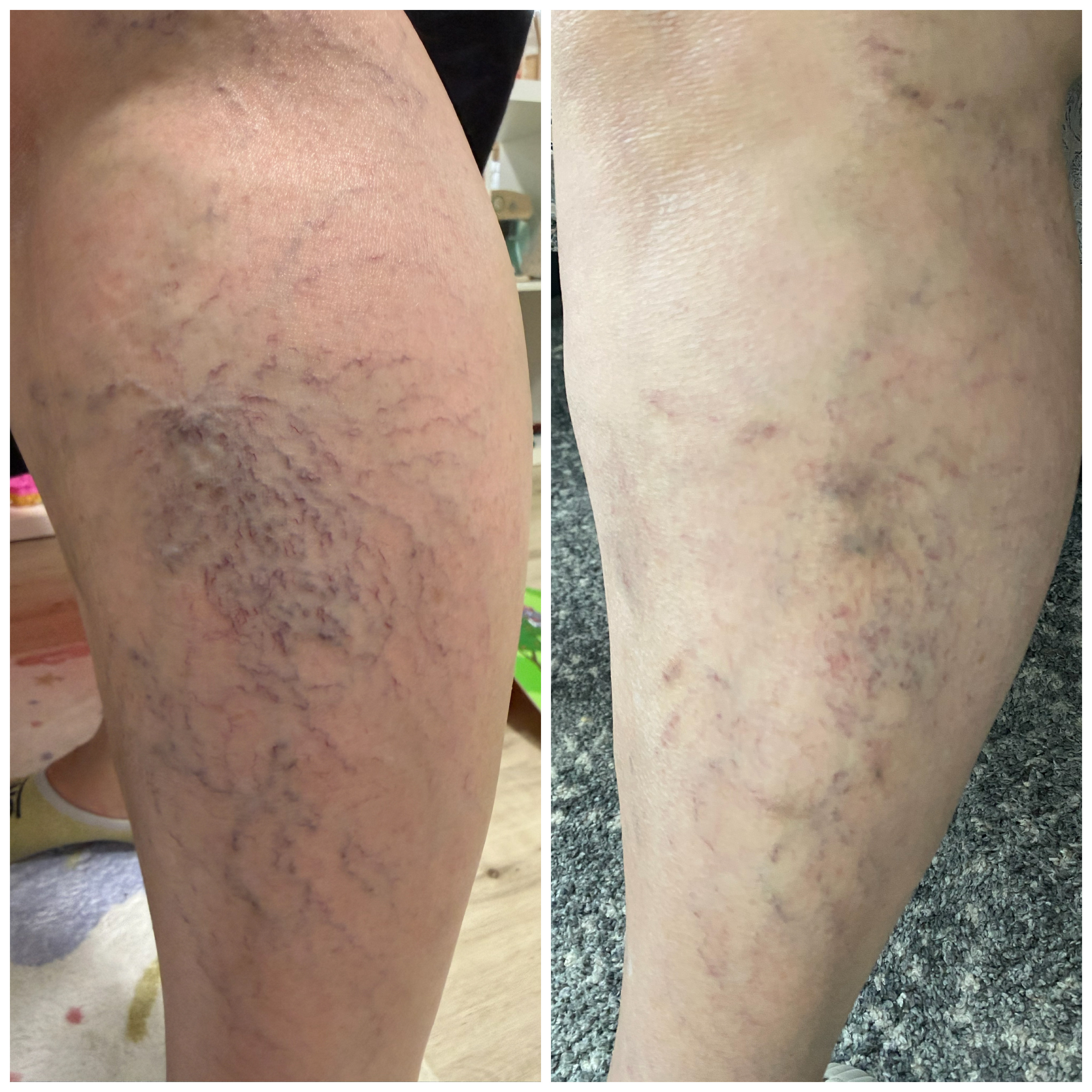 Before & After Results