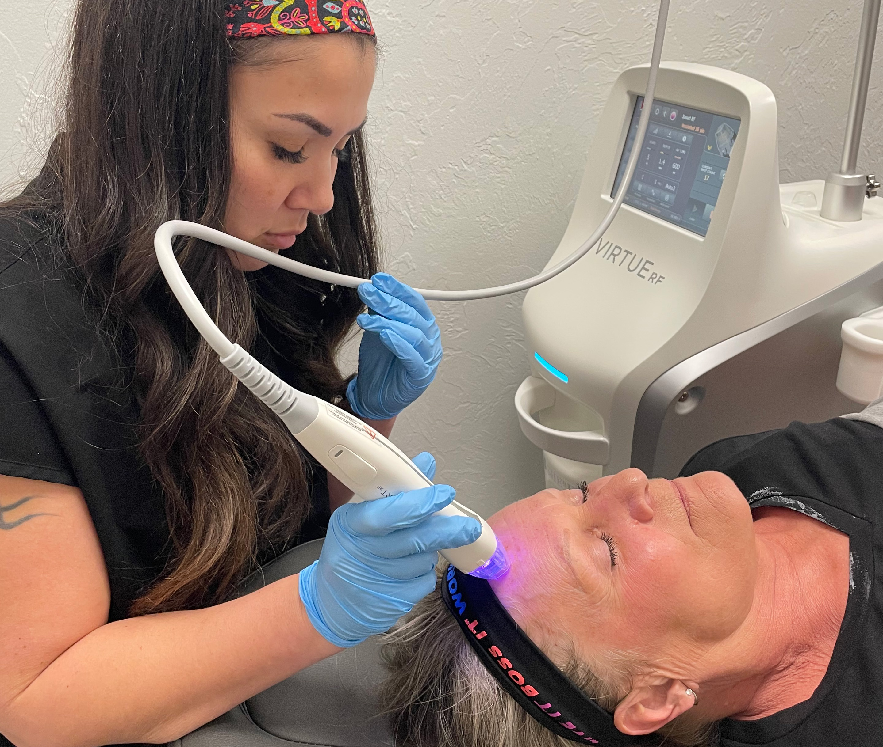 What is RF Microneedling?