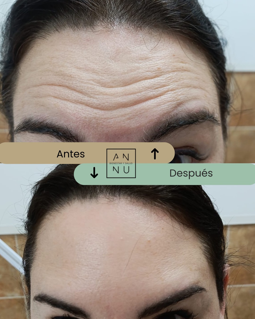 Resultados Neuromodeladores