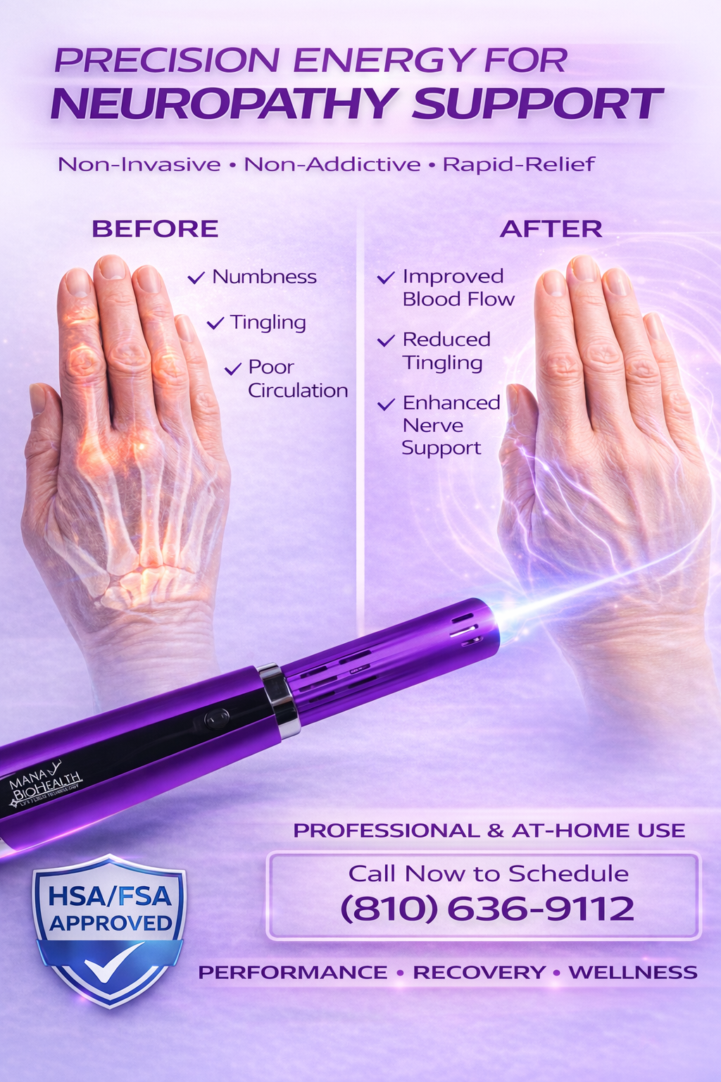 Neuropathy in the Hands and Fingertips: A Non-Invasive Approach to Nerve Support