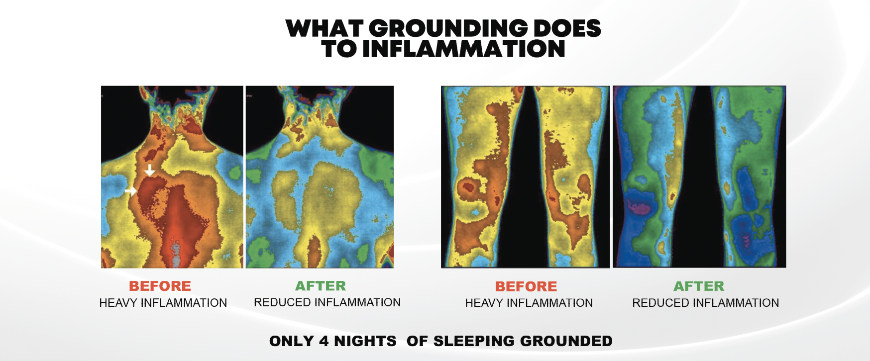 Inflammation reduction with grounding
