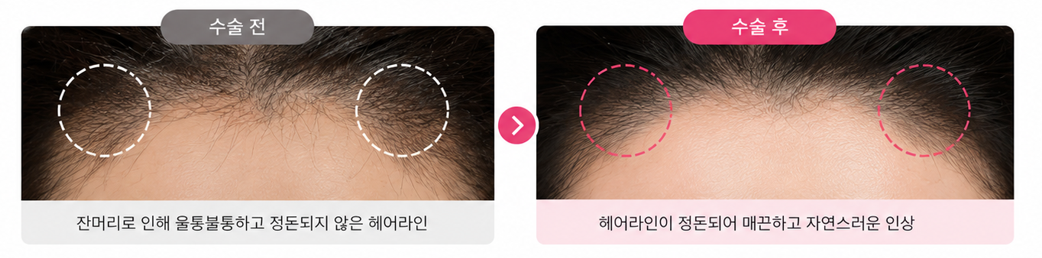 추가 이미지 4