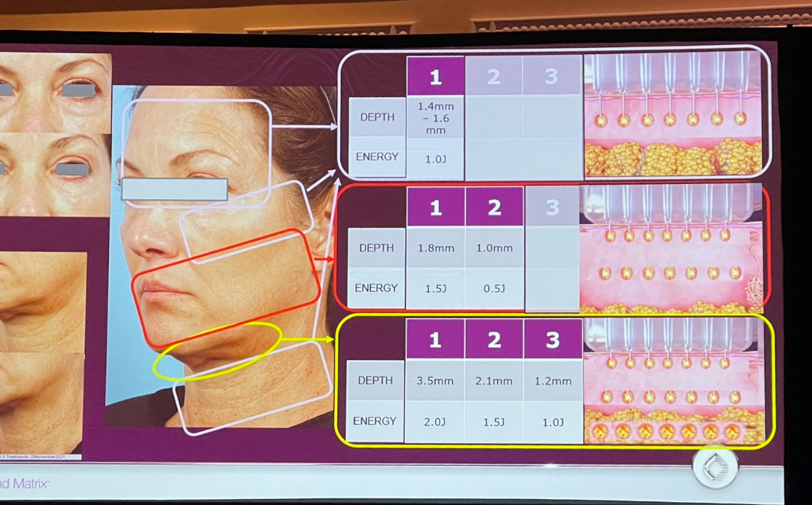Matrix Pro Treatment Room