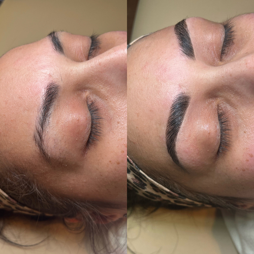 Brow Services results